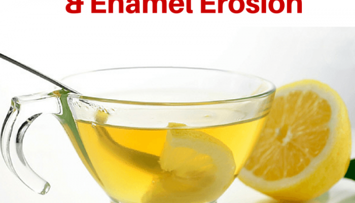 Hot Lemon Water and Enamel Erosion