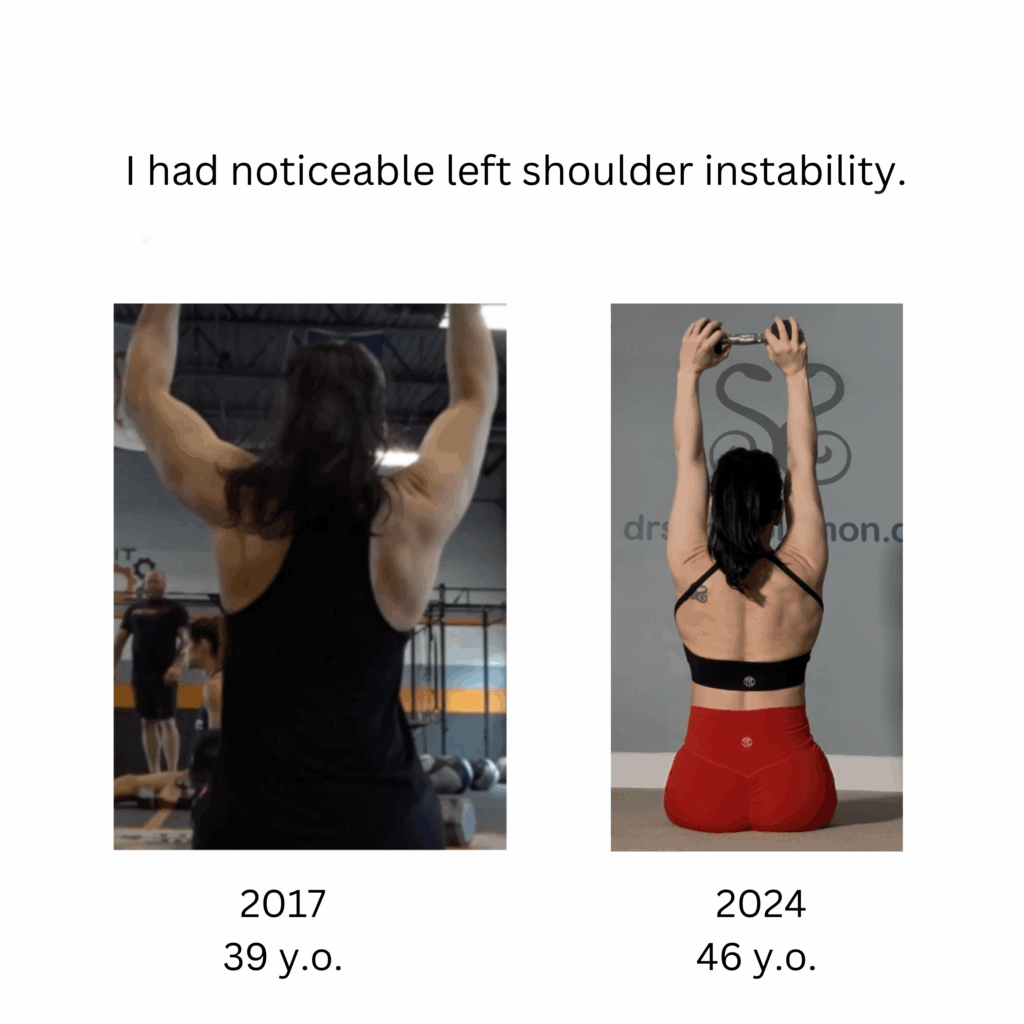 shoulder instability copy