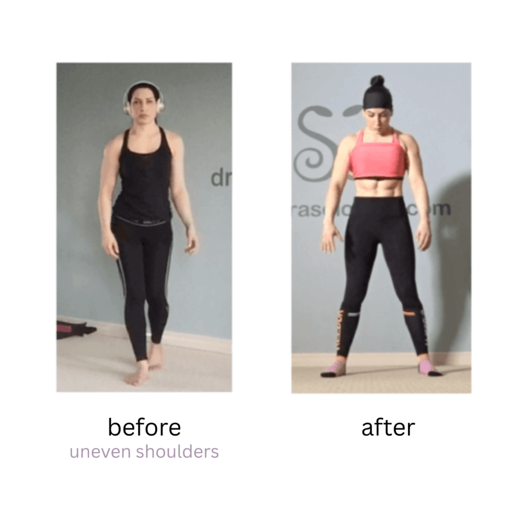 fix uneven shoulders program